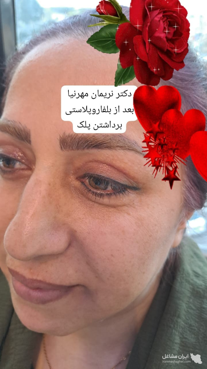 مطب تخصصی پوست و مو دکتر نریمان مهرنیا در تهرانپارس تهران